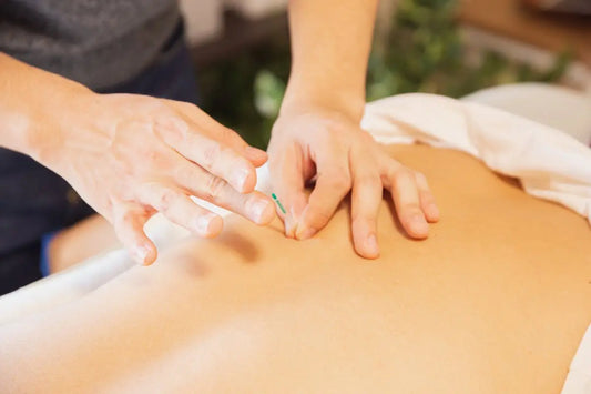 7 Essential Tips for Athletes Using Acupuncture Needles for Pain Management
